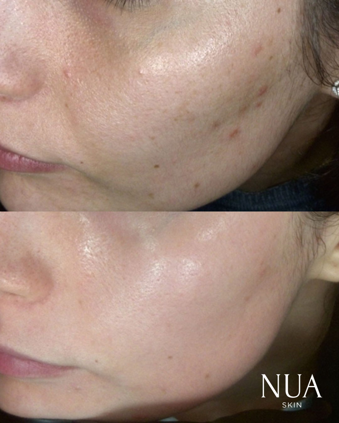 Before and after skin treatment — Clarity Restored